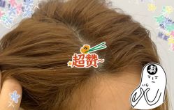 -大麦微针植发全国连锁