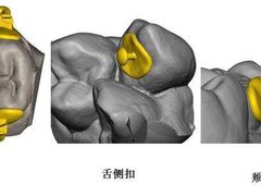 -团圆口腔·种植中心(锦江院区)