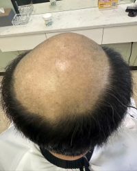 -唐风采假发补发定制