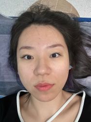 -More摩尔医美の注射线雕光电中心