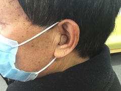 宝山奥迪康耳道式定制款-宁耳听力助听器奥迪康·峰力·西门子(宝山店)