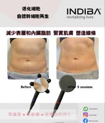 -半岛故事·法儿曼抗衰·indiba中心