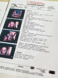 -艾博尔医院