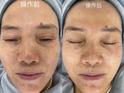 -Cream88颜皮肤管理中心