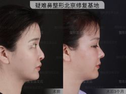 -北京米扬丽格医疗美容·联合丽格鼻整形中心