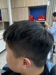 点击看大图 -大麦微针植发全国连锁