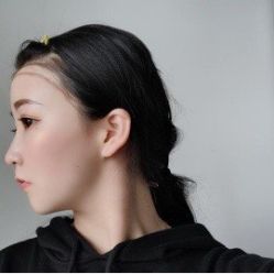 -新生植发·植养护一体