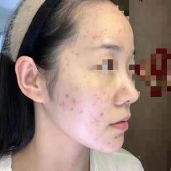 -VE专注问题肌·赛诺龙&科学美肤中心