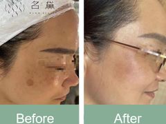 -太原凯宾斯基饭店