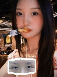 -丰联丽格医疗美容·联合丽格眼整形中心