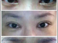 蜕变-上海华安整形外科门诊部