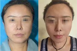 -加减美医美连锁品牌