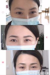 -久匠半永久纹眉