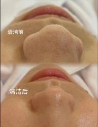 -+MS卓美丝专业祛痘·皮肤管理中心