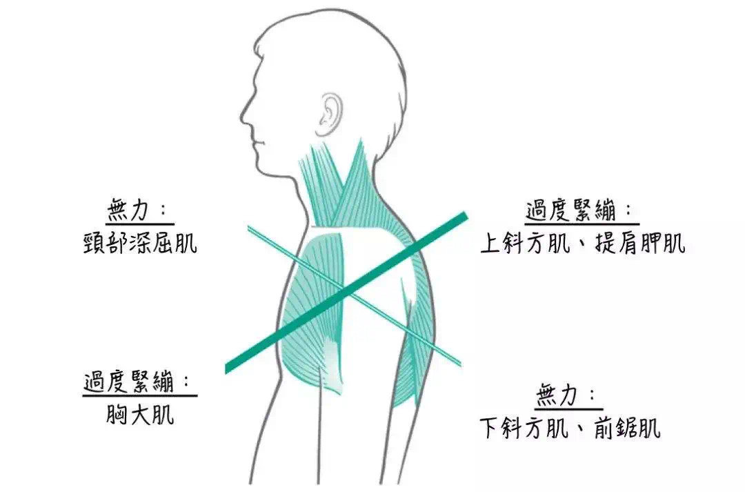 深层颈屈肌训练图片