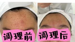 -康美贞·痘肌养护管理中心