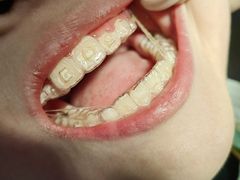 -Dr.Z dental仁康种植矫正中心