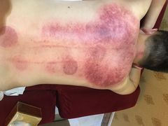 -山里娃养生集团(临朐店)