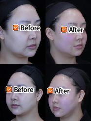 -Yestar重庆艺星医疗美容医院