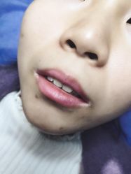 点击看大图 -西施无菌半永久纹绣眉眼影唇轻增发纹发际线