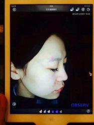 android_upload_pic-哈尔滨瑞丽医疗美容医院