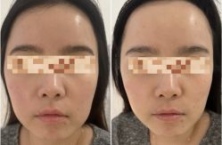 -Yestar 嘉兴艺星医疗美容医院
