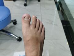 -Andrew指甲专科灰指甲·甲沟炎矫正·3D步态矫形鞋垫定制(浦三路店)