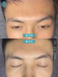 -清疣美疣·痣·斑净肤中心