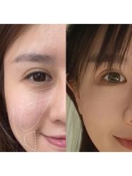 -大麦微针植发全国连锁