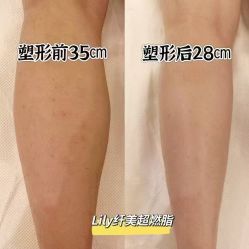 -Lily纤美·科技减脂中心