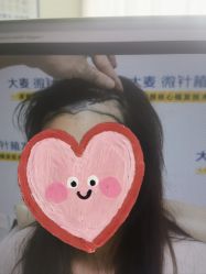 -大麦微针植发丨全国连锁