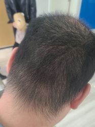 -雍禾植发全国连锁