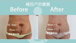 -橘西产后康复中心