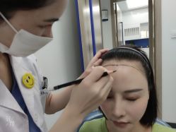 -大麦微针植发全国连锁