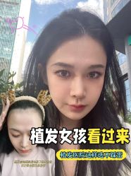 -雍禾植发全国连锁