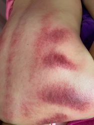 点击看大图 -云珍爱产后修复中心(尚格店)