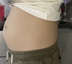 -Fundi张玉珊修身堂·indiba·BTL科技瘦身