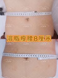 -Lily纤美·科技减脂中心