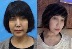 -加减美医美连锁品牌
