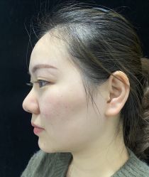 -洁铭新加坡医美