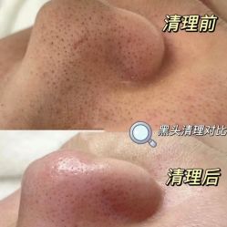 -Cream88颜皮肤管理中心