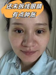 -素美医疗美容·西南眼鼻整形·修复基地