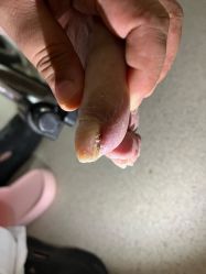 点击看大图 -爱足康修脚·甲沟炎·艾灸养生馆