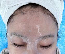 -亿美医疗美容·半岛大超炮官方授权店