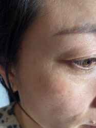 -北京美痣堂古方祛痣斑疣瘊