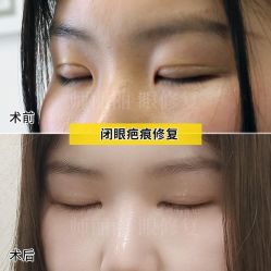 点击看大图 -丰联丽格医疗美容·联合丽格眼整形中心