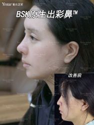 -Yestar重庆艺星医疗美容医院