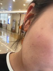 -长沙雅美医疗美容医院