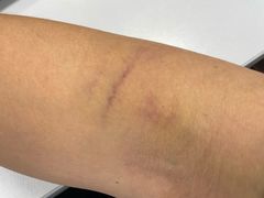 -上海市第八人民医院-体检中心