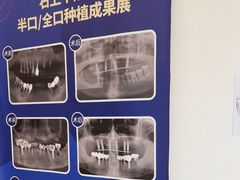 -柏乐口腔(南宁总院)